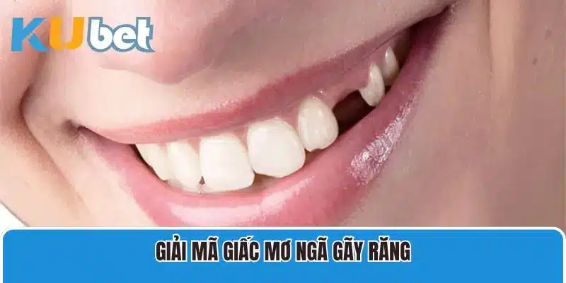 Giải mã giấc mơ ngã gãy răng