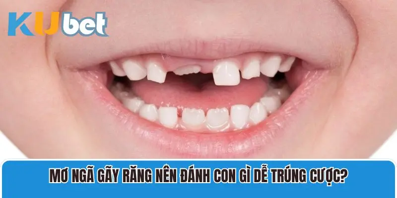 Mơ ngã gãy răng nên đánh con gì dễ trúng cược?