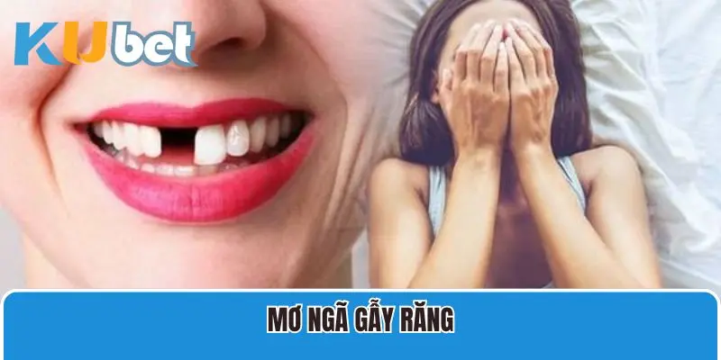 Mơ Ngã Gãy Răng Đánh Con Gì Ăn Đậm Tiền Nhà Cái?